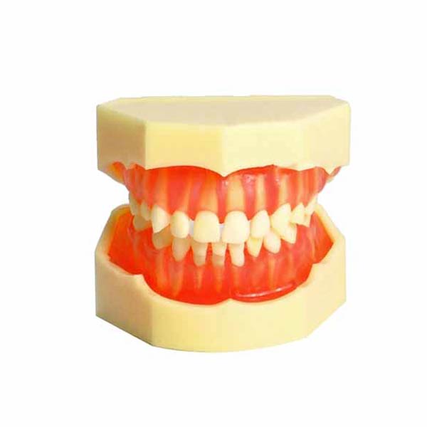 Modèle de dentition amovible pour enfant UM-7009 (20 dents amovibles)
   