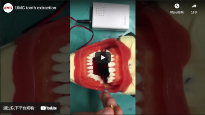 Extraction de dents UMG
    robot