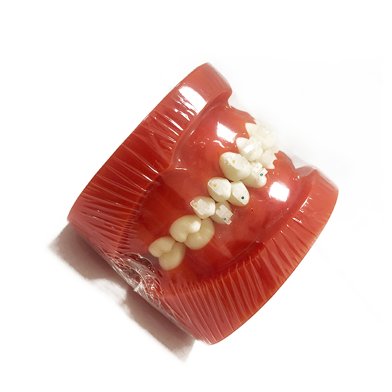 Modèle orthodontique UM-B8 (Brackets en céramique)
   