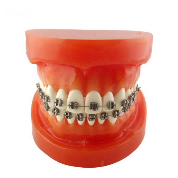 UM-B9 Orthodontic Model (Metal Brackets)
   