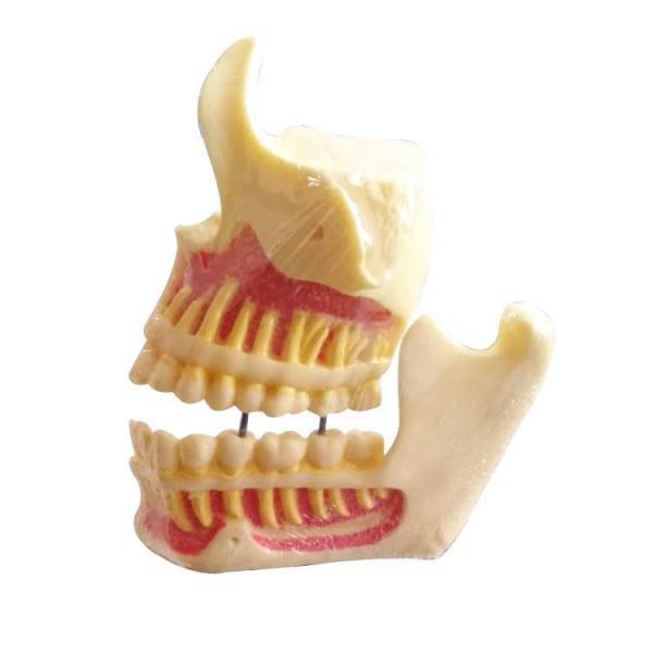 Modèles éducatifs UM-F1 de la mâchoire supérieure et de la mandibule
   