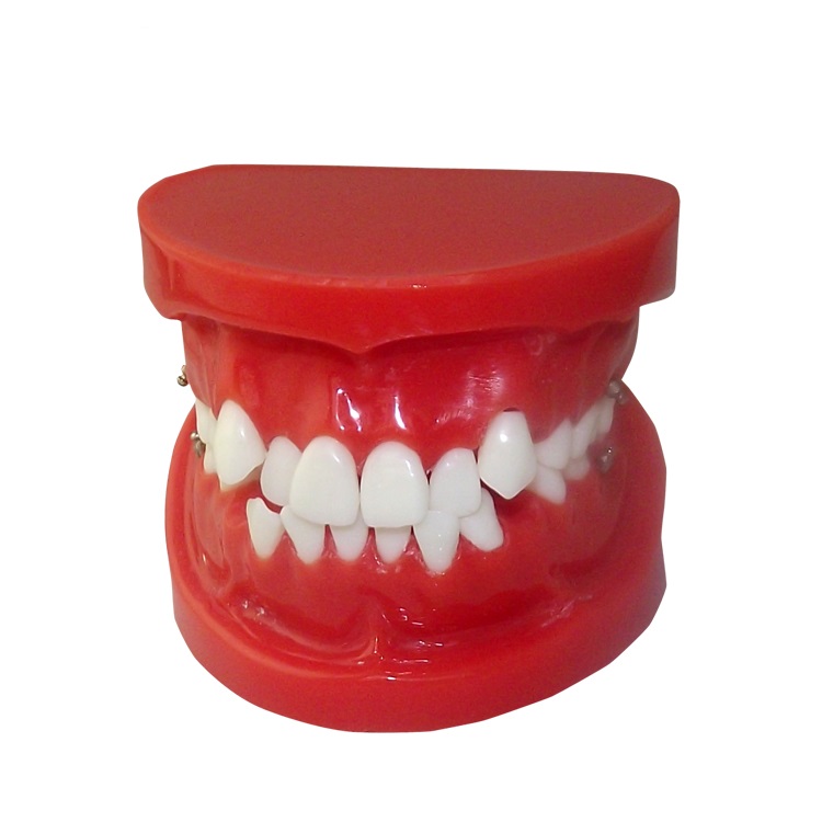 UM-B14 Orthodontic Model
   