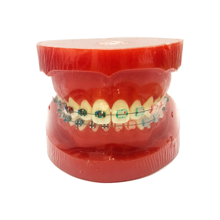 Modèle orthodontique UM-B7 (supports moitié en métal et moitié en céramique)
   