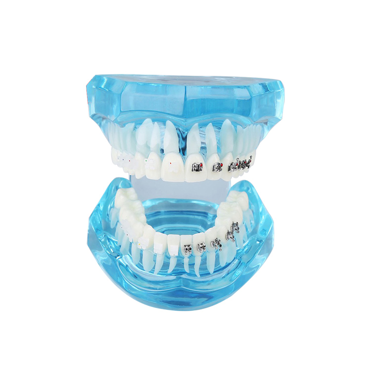 UM-B21 Dentition transparente avec supports
   