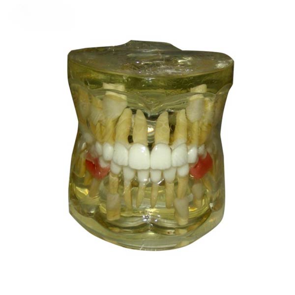 UM-7019 modèle pathologique de la perte précoce des dents primaires