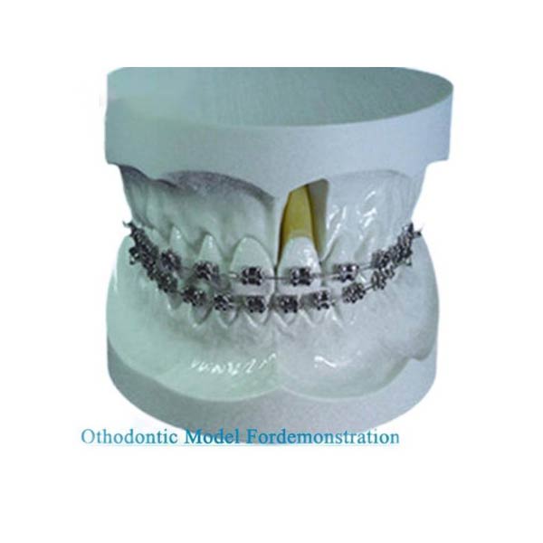 Modèle orthodontique UM-S11 pour la démonstration avec support Edgewise