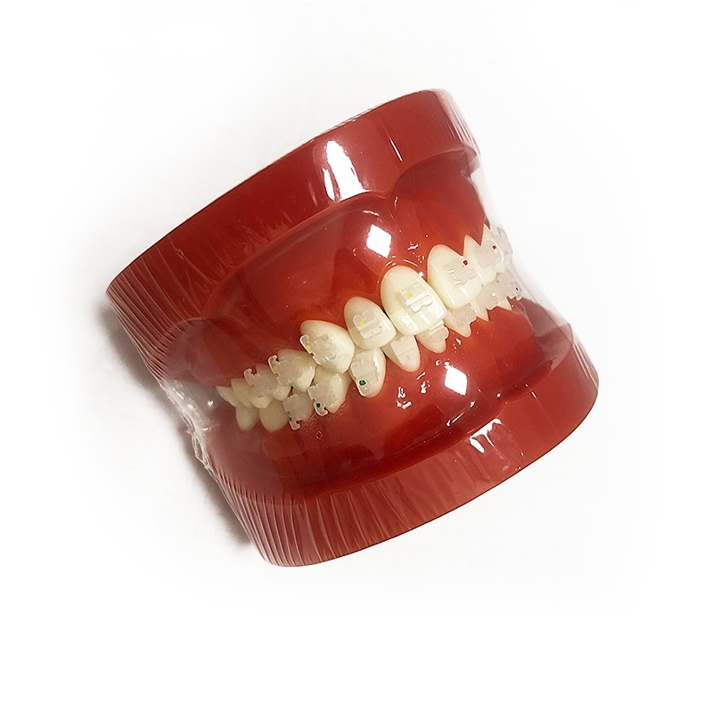 Modèle orthodontique UM-B8 (supports en céramique)