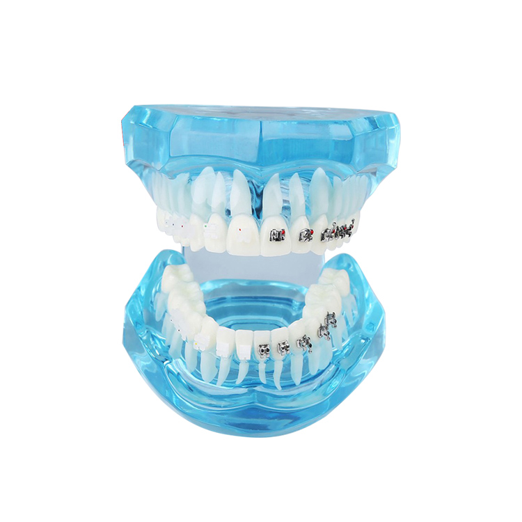 Dentition transparente UM-B21 avec supports