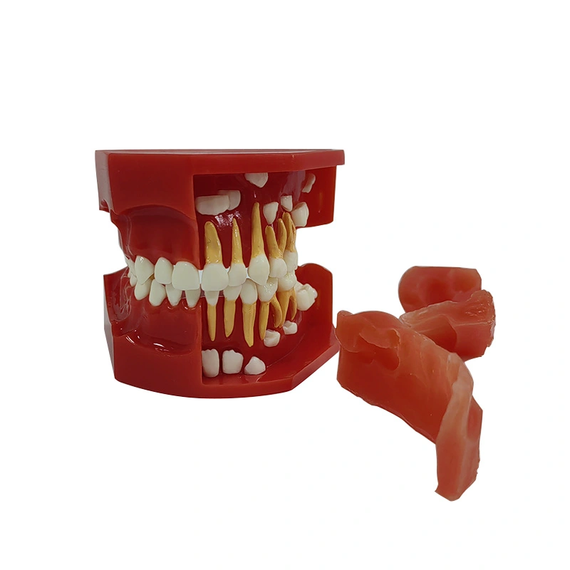 Modèle anatomique de dents - UM-U10 - Tangshan UMG Medical Instrument - de  dentition / de gencive / de démonstration